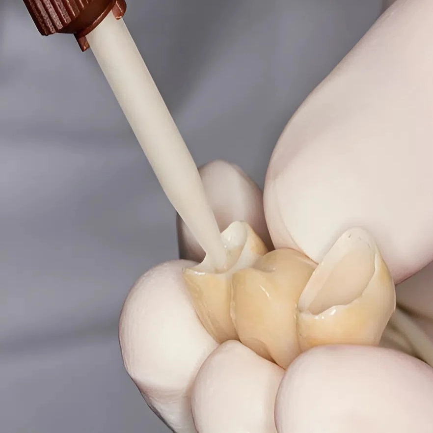 Kéo dán răng sứ bám dính cao nên không thể tháo nguyên vẹn 